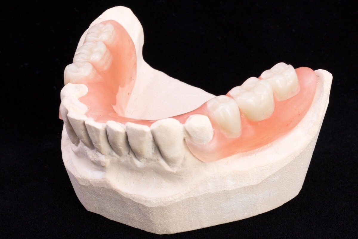 Нейлоновый съемный протез жевательных зубов