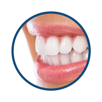 Эстетическое лечение зубов