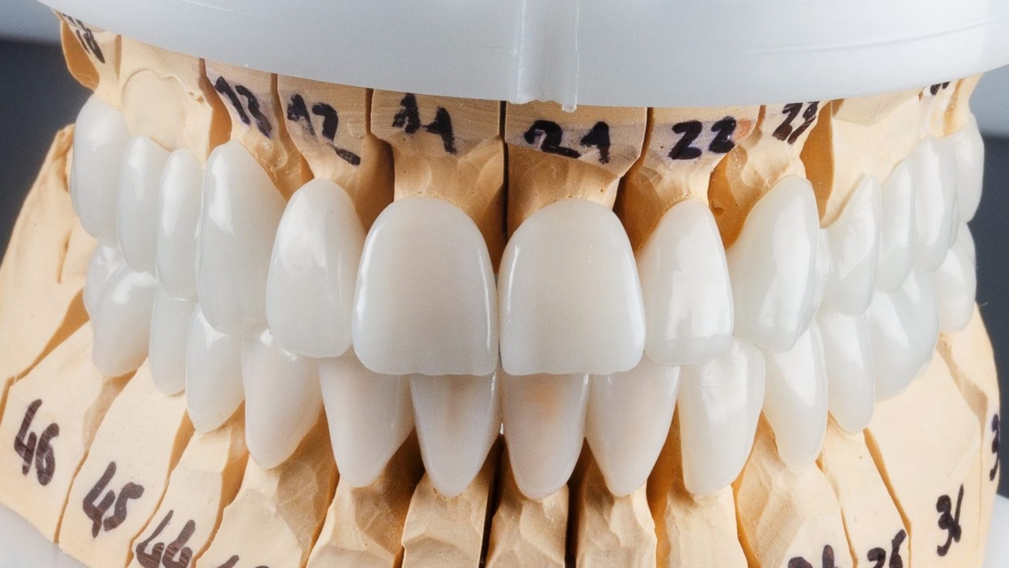 циркониевые коронки перед установки на зубы