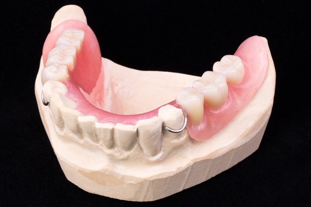 Акриловый съемный протез жевательных зубов