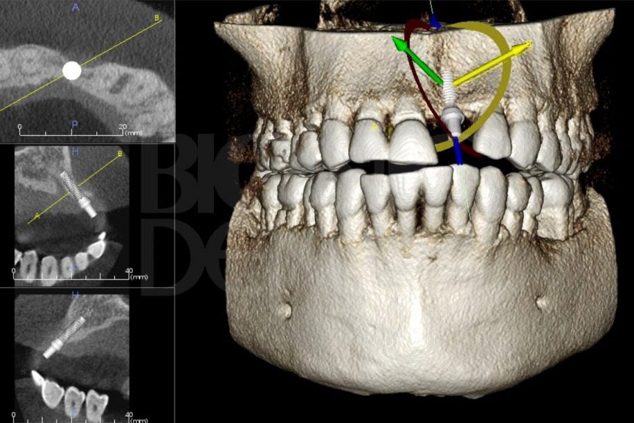 Томография зубочелюстной системы сделанная в процессе консультации стоматолога в клинике Стомион
