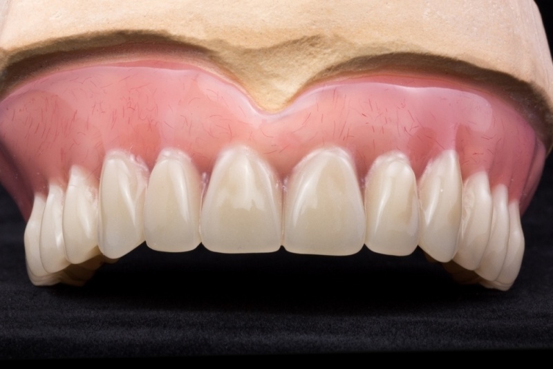 Съемные зубные протезы метод восстановления всех зубов беззубым пациентам