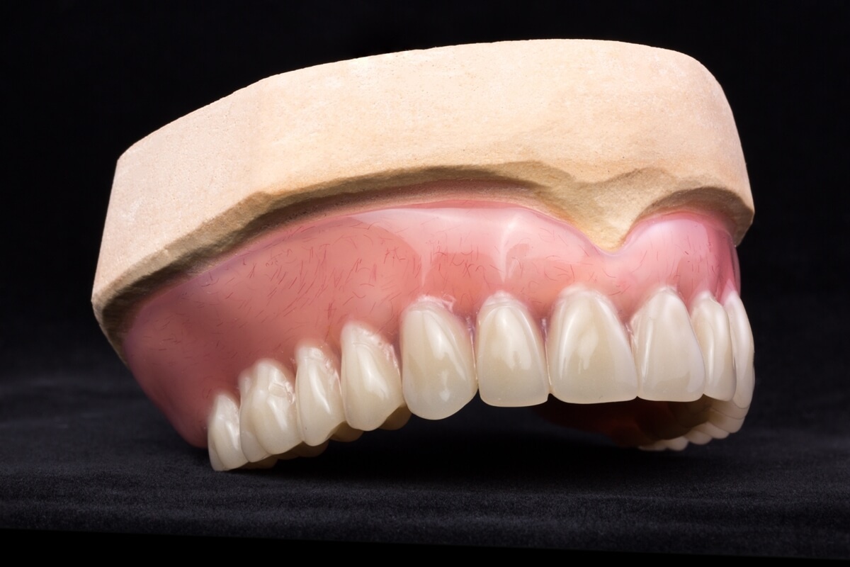 Полный съемный зубной протез верхней челюсти