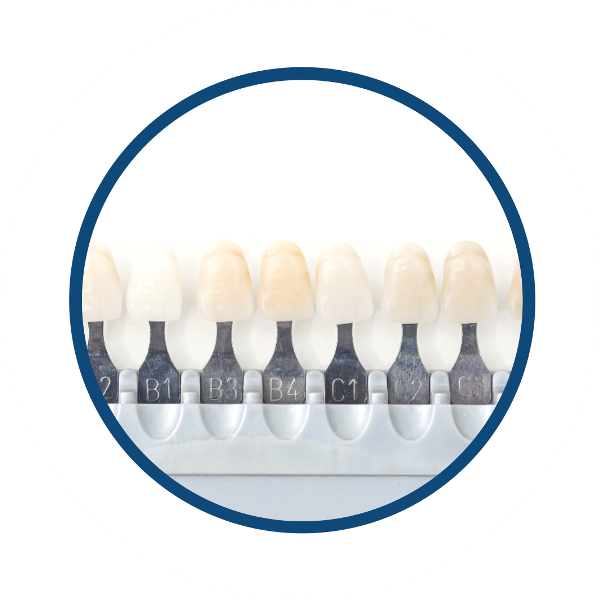 Придание желаемого оттенка коронкам и винирам входит в стоимость протезирования зубов по протоколам цифровой стоматологии