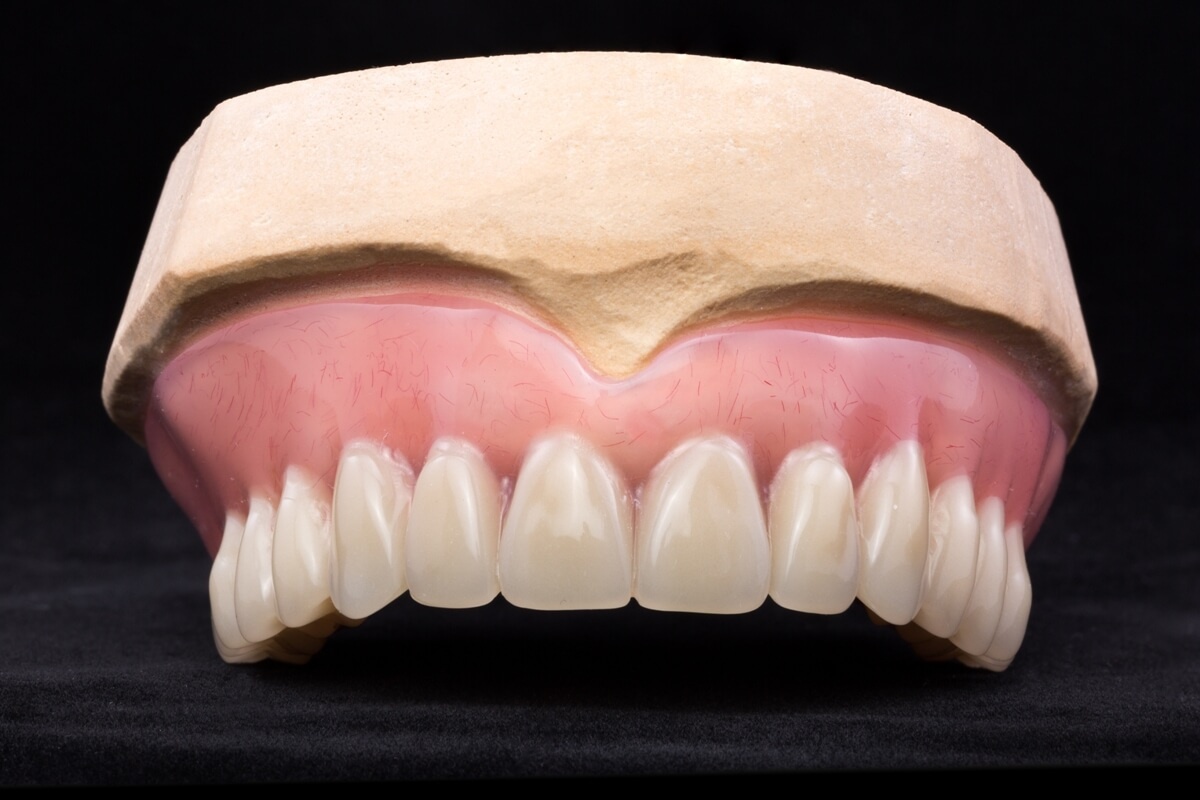 Модель верхней челюсти со съемным полным протезом зубов